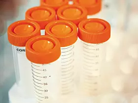 Platz 8: L'Oréal Deutschland
Ein deutschlandweiter Umsatz von 2,43 Milliarden Euro bringt den Pharmariesen auf den achten Platz. 